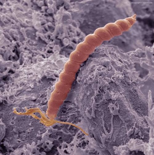 Как восстановить защитные свойства желудка.. Что делать при повышенной кислотности желудка 01 Как восстановить защитные свойства желудка.. Что делать при повышенной кислотности желудка 01