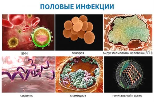 Протозойные инфекции в гинекологии. Александр Коловангин, уролог-андролог, онколог. Редактор А. Герасимова