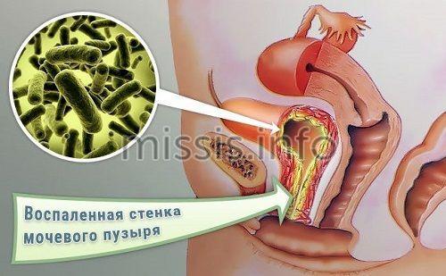8 правил сохранения здоровья влагалища.  Как изменяется флора в течение жизни? 02 8 правил сохранения здоровья влагалища.  Как изменяется флора в течение жизни? 02